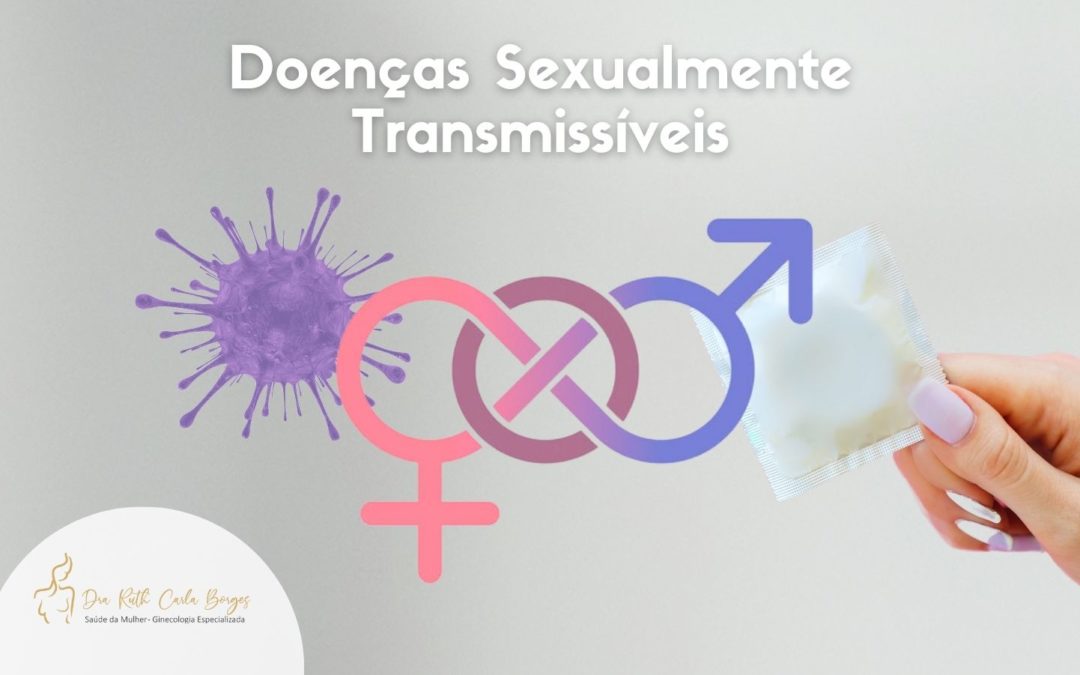 Doenças Sexualmente Transmissíveis